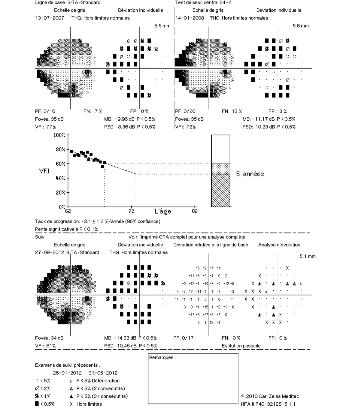 Champ visuel progression